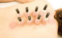 拔罐减肥的原理是什么 找准穴位就能一瘦到底