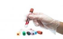 什么是血常规检查？血常规化验单怎么看？