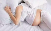 四维彩超检查什么？四维彩超有必要做吗？