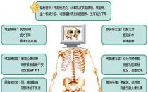 电脑危害人体图