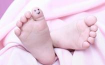 怎样治脚丫痒才好