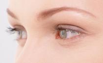 眼睛飞蚊症是怎么回事