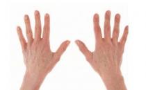 过敏性皮炎湿疹该怎么办