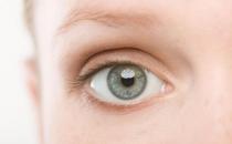 如何预防干眼症？干眼症的症状