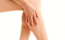 腿肿久久不消是怎么回事