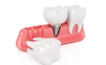 牙齿过早脱落当心是牙周炎！