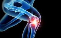 关节炎患者该如何自我护理