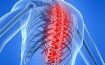 怎么做才有效预防腰椎病