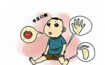 什么是手足口病？手足口病怎么治疗