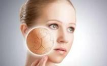 冬季=皮肤干燥瘙痒保养方法 皮肤干燥常吃3种蔬菜