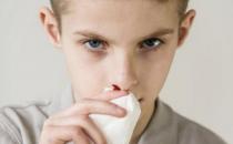 流鼻血和癌症是否有关系 勿忽视身体发出的求救信号