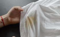 白色T恤沾上辣椒油 轻松洗掉衣服上辣椒油的妙招