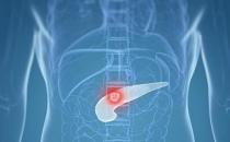 胰腺炎死亡率高达70％ 胰腺炎发病给人体发出的警报