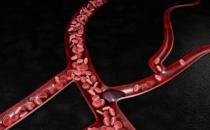 预防血栓平时多吃黑色食物 晚睡前喝杯开水预防血栓