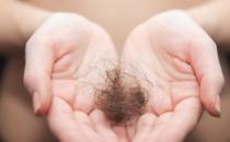 防止掉头发除了食疗还要日常护理 脱发饮食保健推荐