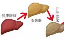 贵州治丙肝医院靠不靠谱 贵州中医肝病医院质量医疗的践行者