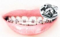 武汉德韩口腔真相大揭秘，金属矫正的过程会不会很疼？