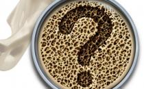 骨质疏松的常见认知误区 看看你有没有中招