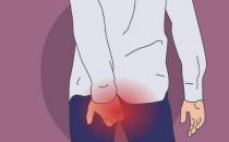 南充市东大肛肠医院技术好吗 告诉你痔疮如何防治