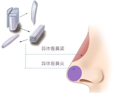 北京圣慈整形医院鼻子王王军怎么样？专业实力 让你放心美