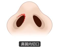 北京圣慈整形医院鼻子王王军怎么样？专业实力 让你放心美