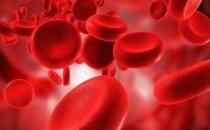 血液垃圾带来危害 多吃9类食物有效清理血液垃圾