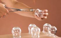 拔火罐减肥能减肥吗 拔火罐减肥有哪些注意事项