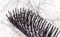 女性白领改善脱发问题 推荐10款食谱防脱发